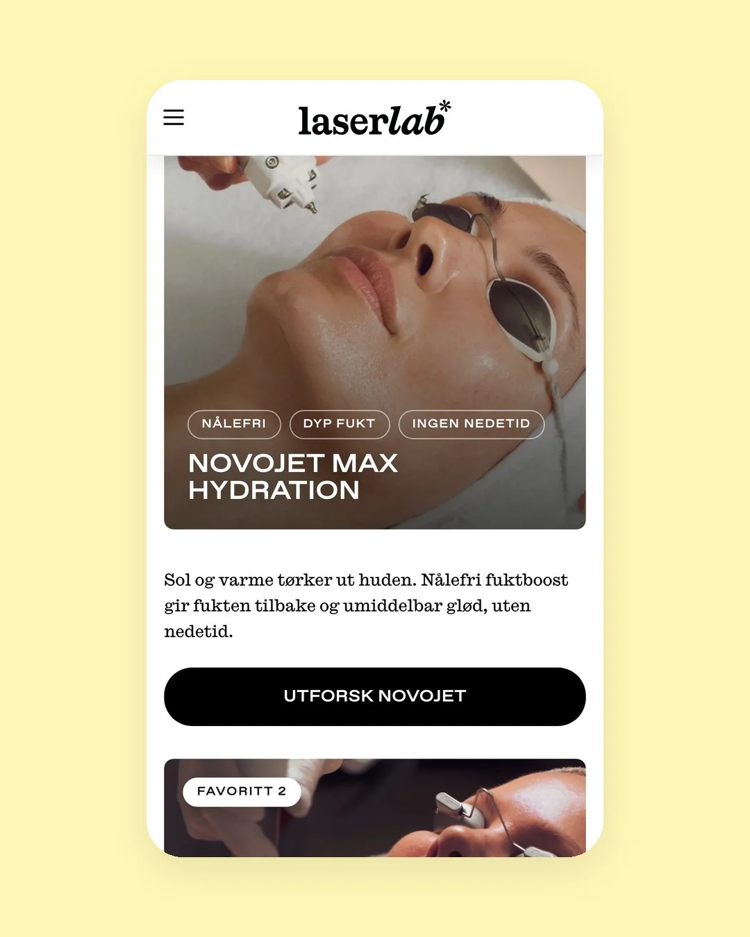 Laserlabs digitale løsning på mobil