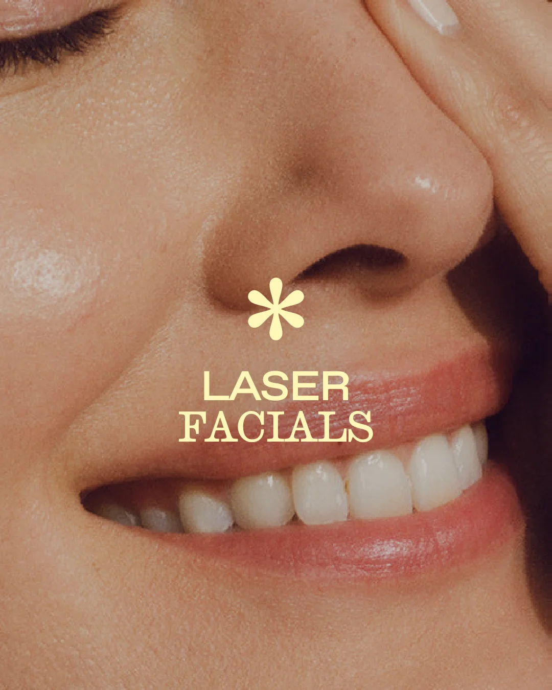 Laser facials